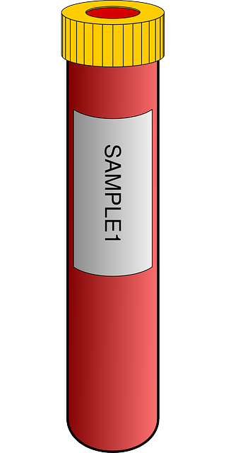 Free download Blood Sample Tube - Free vector graphic on Pixabay free illustration to be edited with GIMP free online image editor