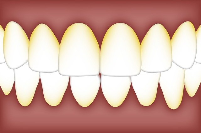 Free download Dental Plaque Biofilm -  free illustration to be edited with GIMP free online image editor