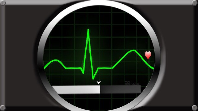 הורדה חינם Ecg Health Pulse - איור חינם לעריכה עם עורך תמונות מקוון בחינם של GIMP