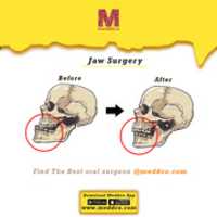 Free download Jaw Surgery free photo or picture to be edited with GIMP online image editor