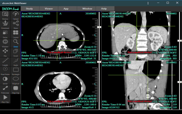 dicom.link Dicom Viewer  from Chrome web store to be run with OffiDocs Chromium online