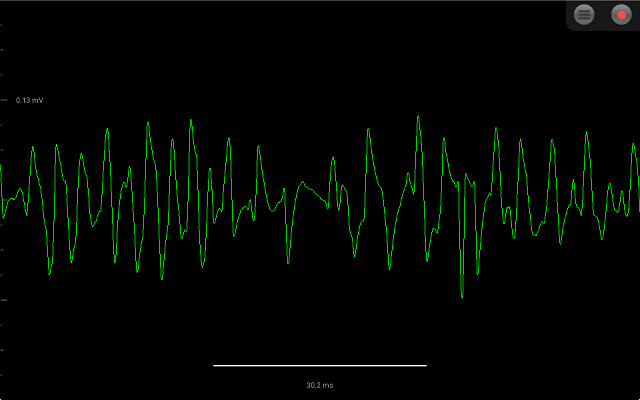 Spike Recorder  from Chrome web store to be run with OffiDocs Chromium online