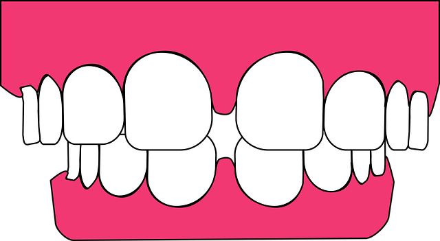 Free download Teeth Dental - Free vector graphic on Pixabay free illustration to be edited with GIMP free online image editor