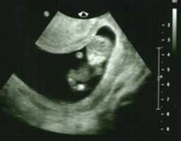 Free download ultrasound free photo or picture to be edited with GIMP online image editor