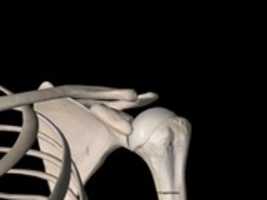 Free download Acromioclavicular Joint free photo or picture to be edited with GIMP online image editor