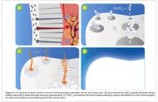 Free download bioceramics-development-applications-Exposure-dentin-tubules-6-096-g004 free photo or picture to be edited with GIMP online image editor