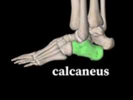 Free download Calcaneus Left, Lateral View free photo or picture to be edited with GIMP online image editor