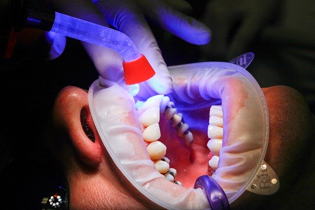 Free download dentist facet uv light curing free picture to be edited with GIMP free online image editor