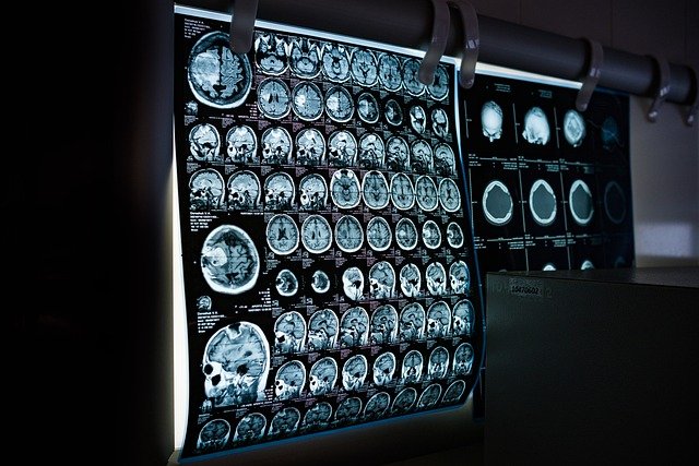 Free download x ray mri ct scan free picture to be edited with GIMP free online image editor