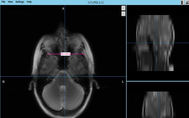 MRI Scalar  from Chrome web store to be run with OffiDocs Chromium online