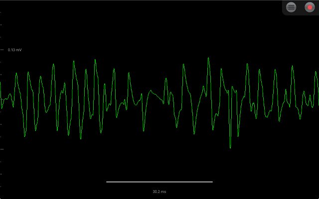 Spike Recorder  from Chrome web store to be run with OffiDocs Chromium online