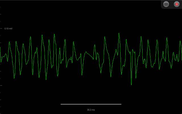 Spike Recorder uit de Chrome-webwinkel kan worden uitgevoerd met OffiDocs Chromium online