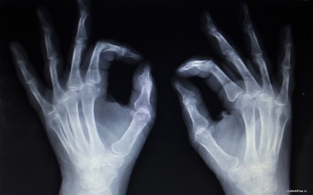 X ray  from Chrome web store to be run with OffiDocs Chromium online