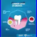 How To Cure Gingivitis At Home  screen for extension Chrome web store in OffiDocs Chromium